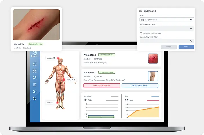 AI-Powered wound imaging module image