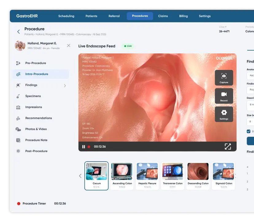 Live endoscope video feed inside the colonoscopy procedure record in gastroenterology EHR software with image capture and structured findings