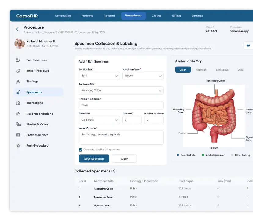 Specimen collection and labeling screen in gastroenterology EHR software with multi-jar biopsy entry, anatomic colon site map and collected specimen list