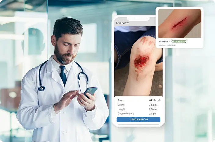 wound mobile app and remote image